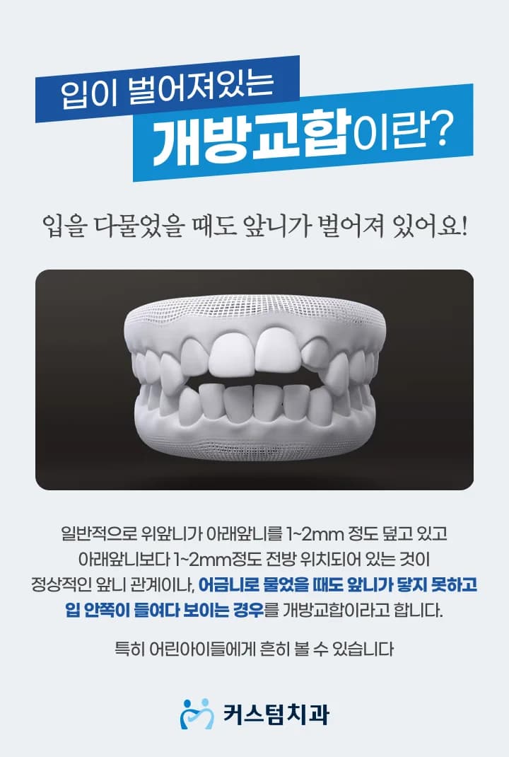 어금니는 닿는데 앞니가 안 다물립니다 — 개방교합의 원인은 치아가 아닐 수 있습니다