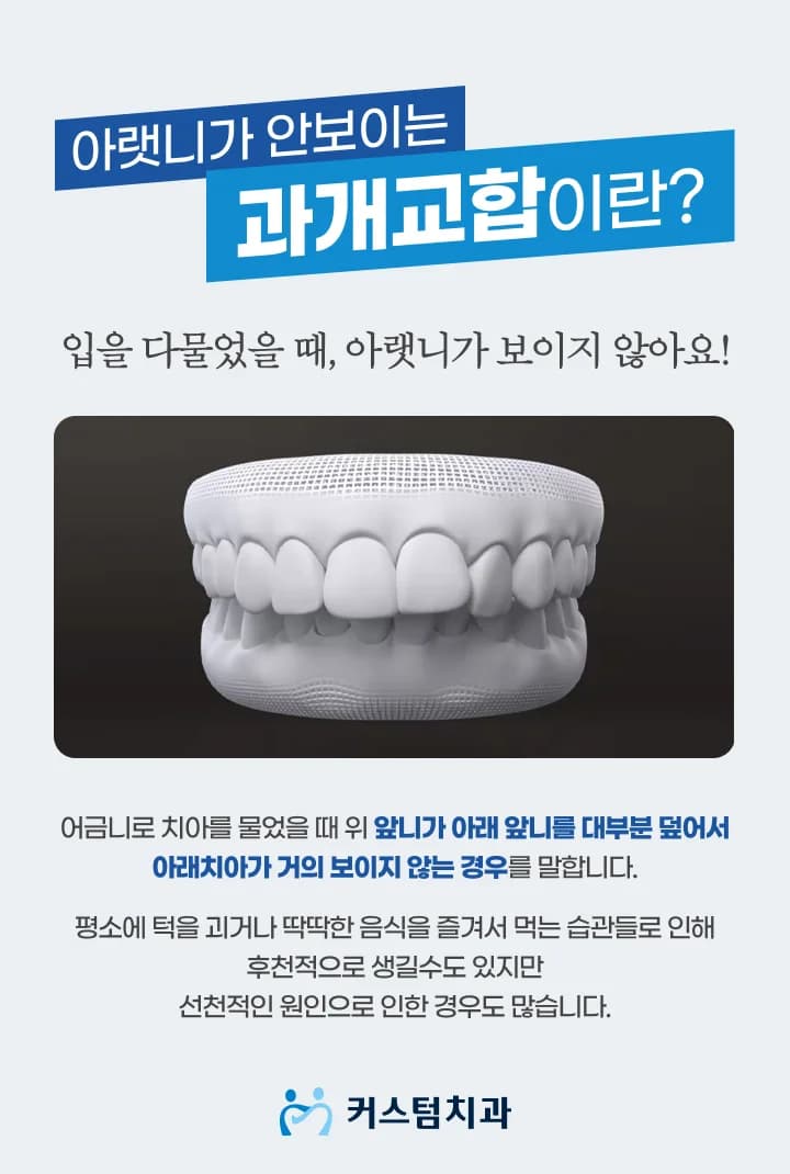 위 앞니가 아래를 너무 많이 덮습니다 — 과개교합을 그냥 두면 생기는 일