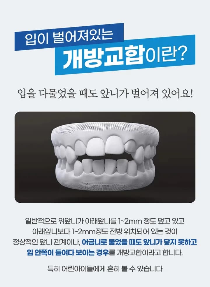 어금니는 닿는데 앞니가 안 다물립니다 — 개방교합의 원인은 치아가 아닐 수 있습니다